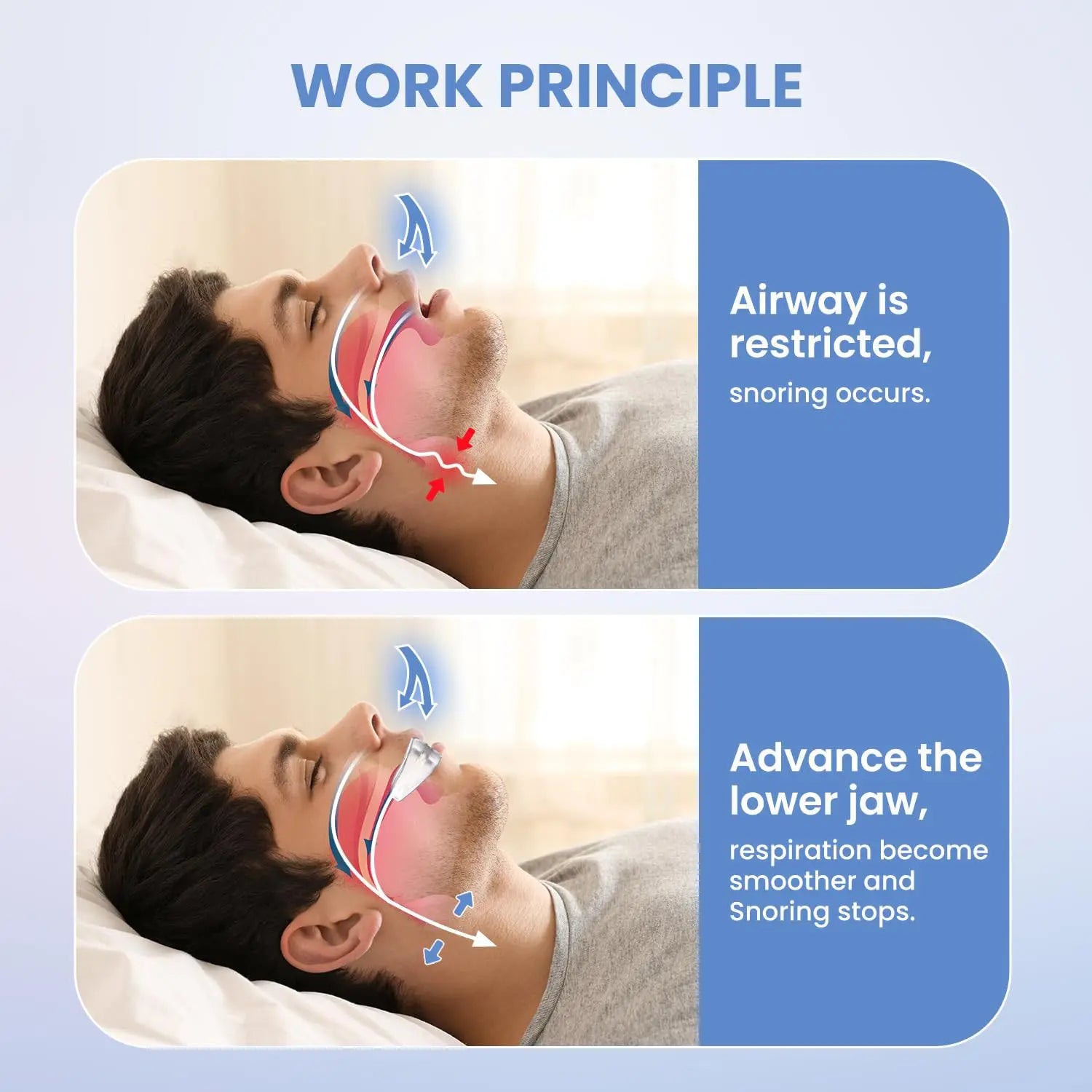 Snoring Mouth Guard | Anti Snoring Device for Bruxism and Sleep Apnea Relief