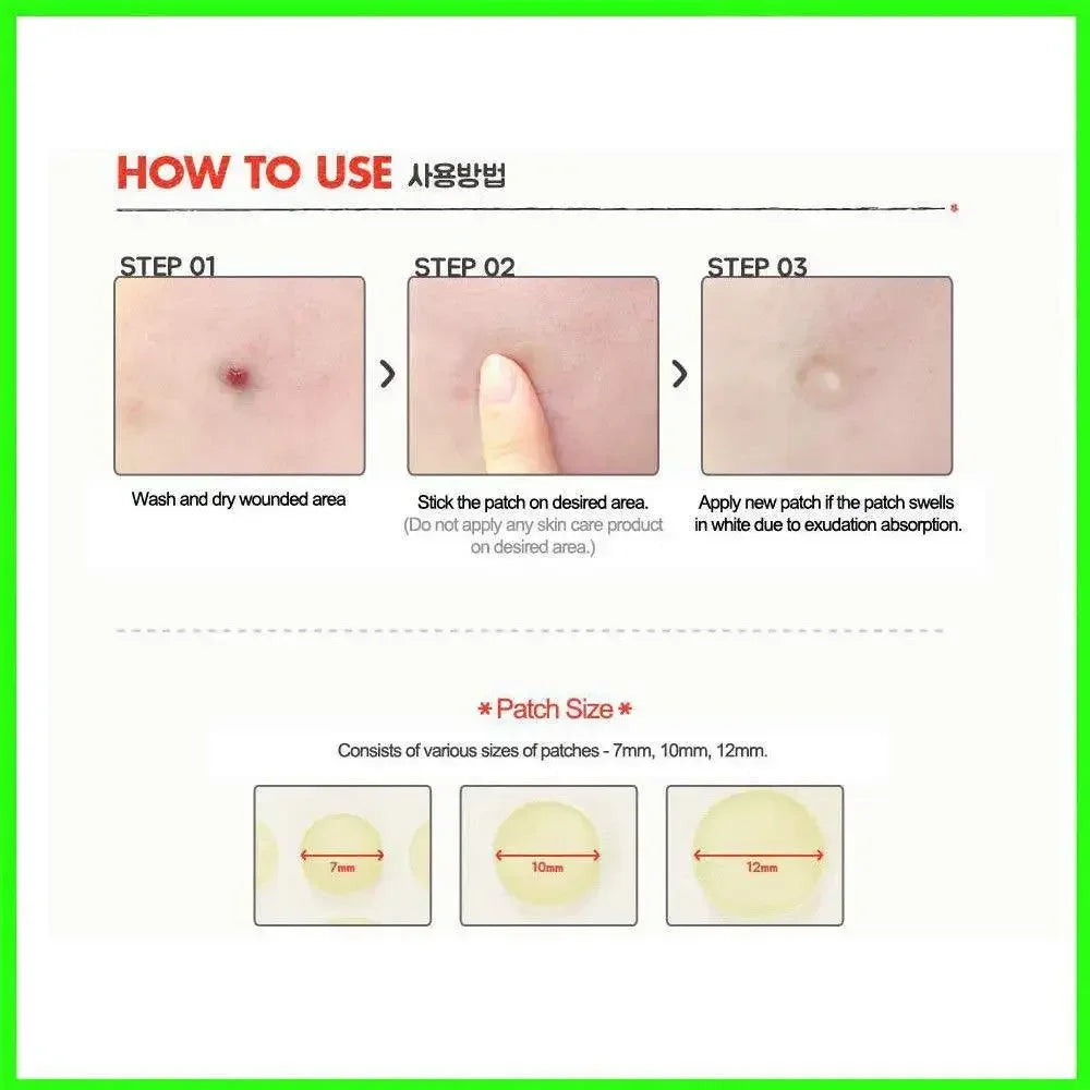 24 Pcs Hydrocolloid Acne Patches | Pimple Spot Treatment Stickers for Face