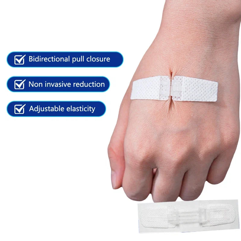 Zipper Bandage Wound Closure Patch | Suture-Free First Aid Dressing