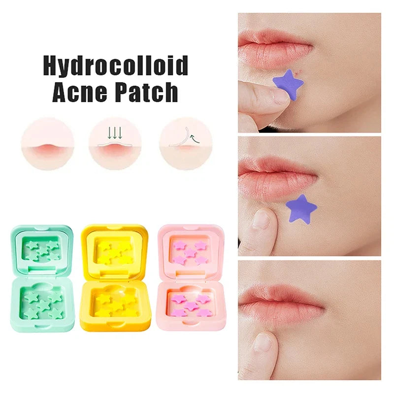 Star Shaped Hydrocolloid Acne Patches | Invisible Pimple Stickers with Mirror