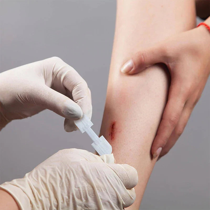 Zipper Bandage Wound Closure Patch | Suture-Free First Aid Dressing