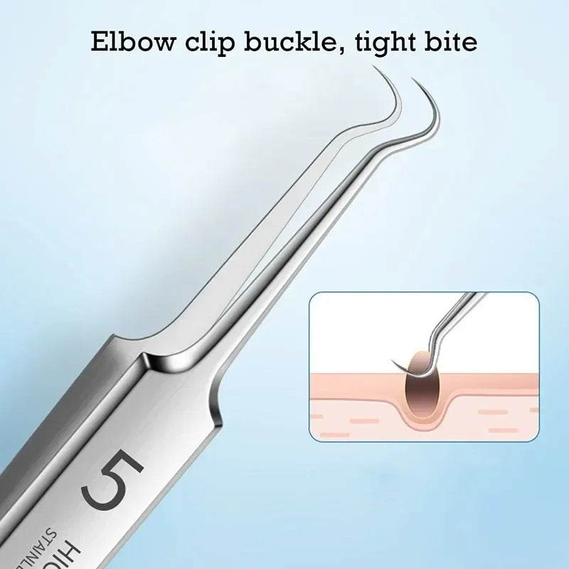 Ultra-Fine Blackhead Remover Tweezers | Precision Acne Extraction Tool