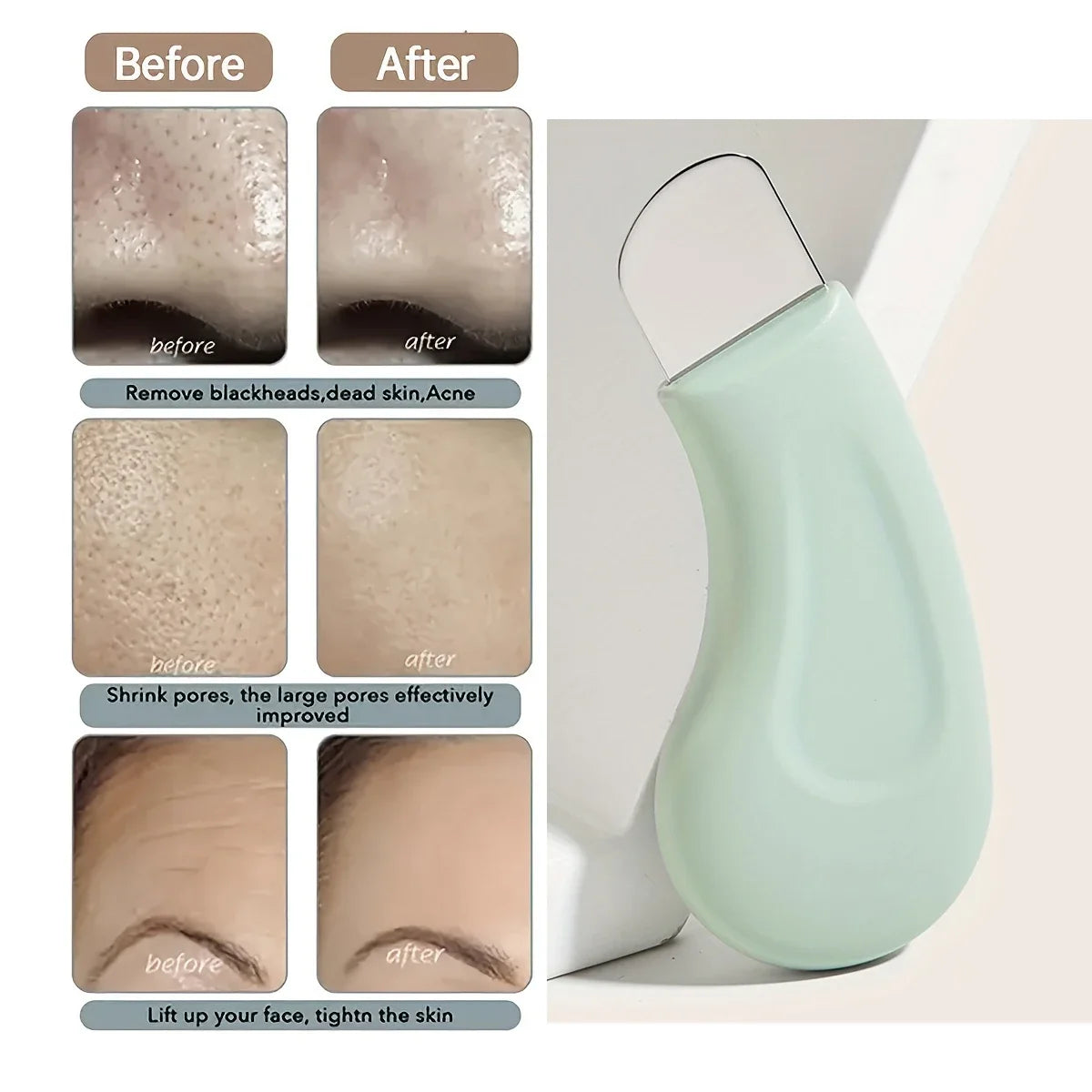 Facial Blackhead Removal Tool | Nose Deep Cleansing Skincare Tool