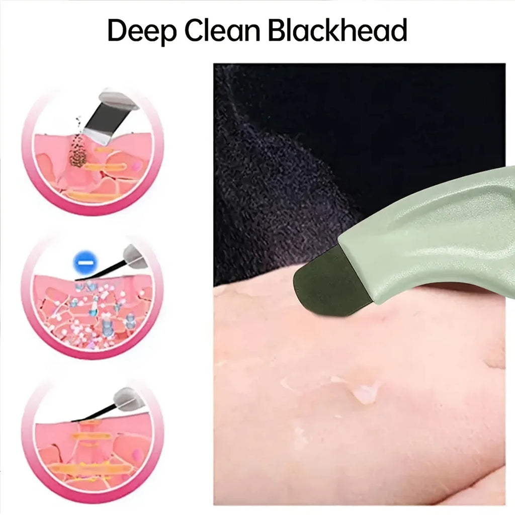 Facial Blackhead Removal Tool | Nose Deep Cleansing Skincare Tool