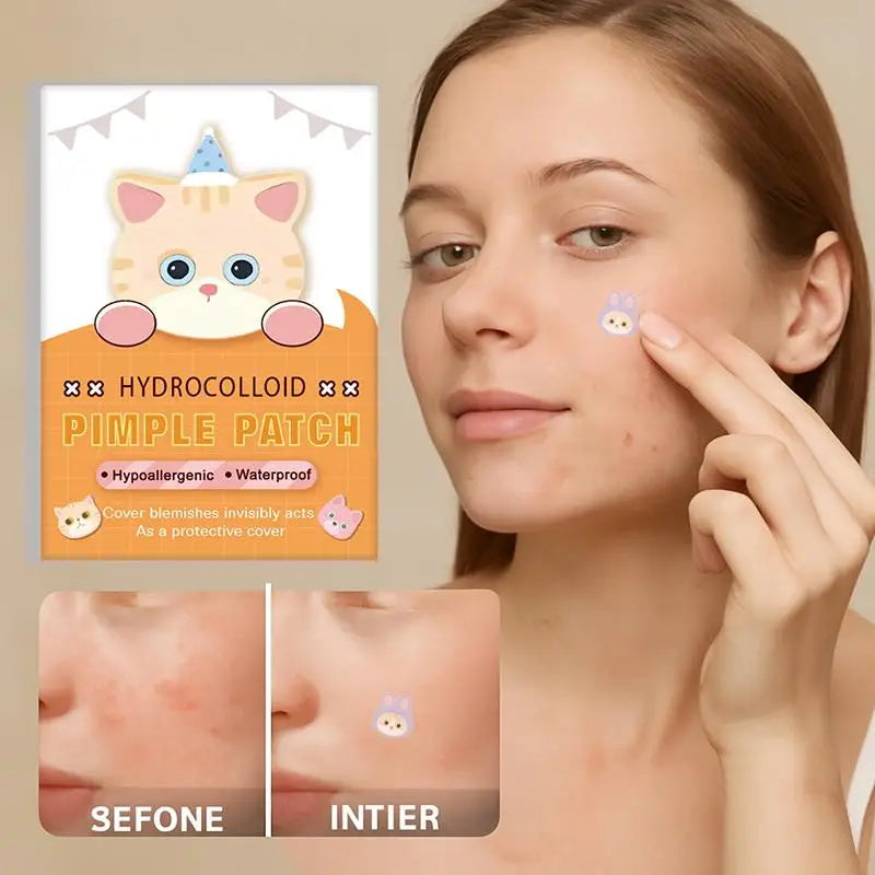 600 Pcs Cat Shaped Acne Patches | Hydrocolloid Pimple Stickers with Cute Design
