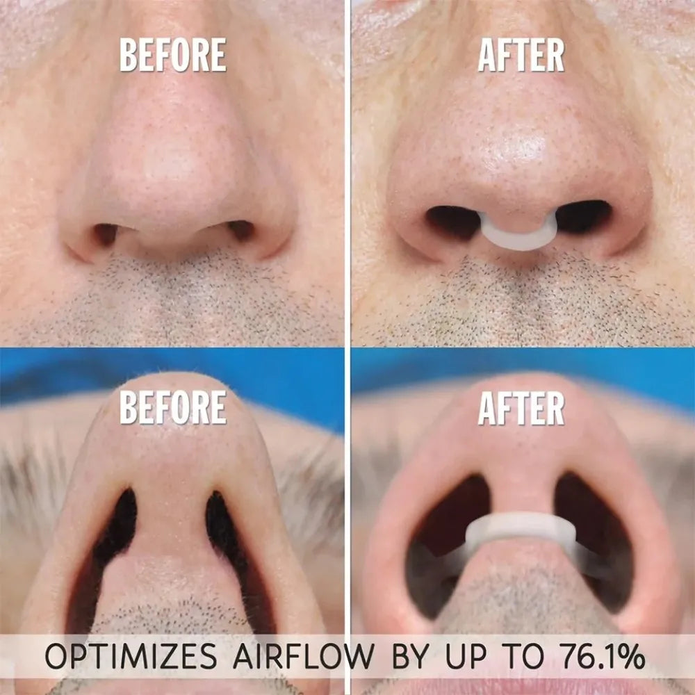 Anti Snoring Nose Clip | Gentle Sleep Aid for Men and Women