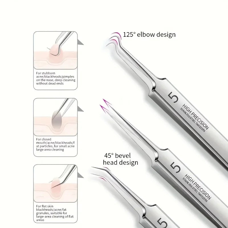 1/3pcs Extra Fine No. 5 Cellular Acne Blackhead Tweezers | Facial Beauty Tool for Skin Care