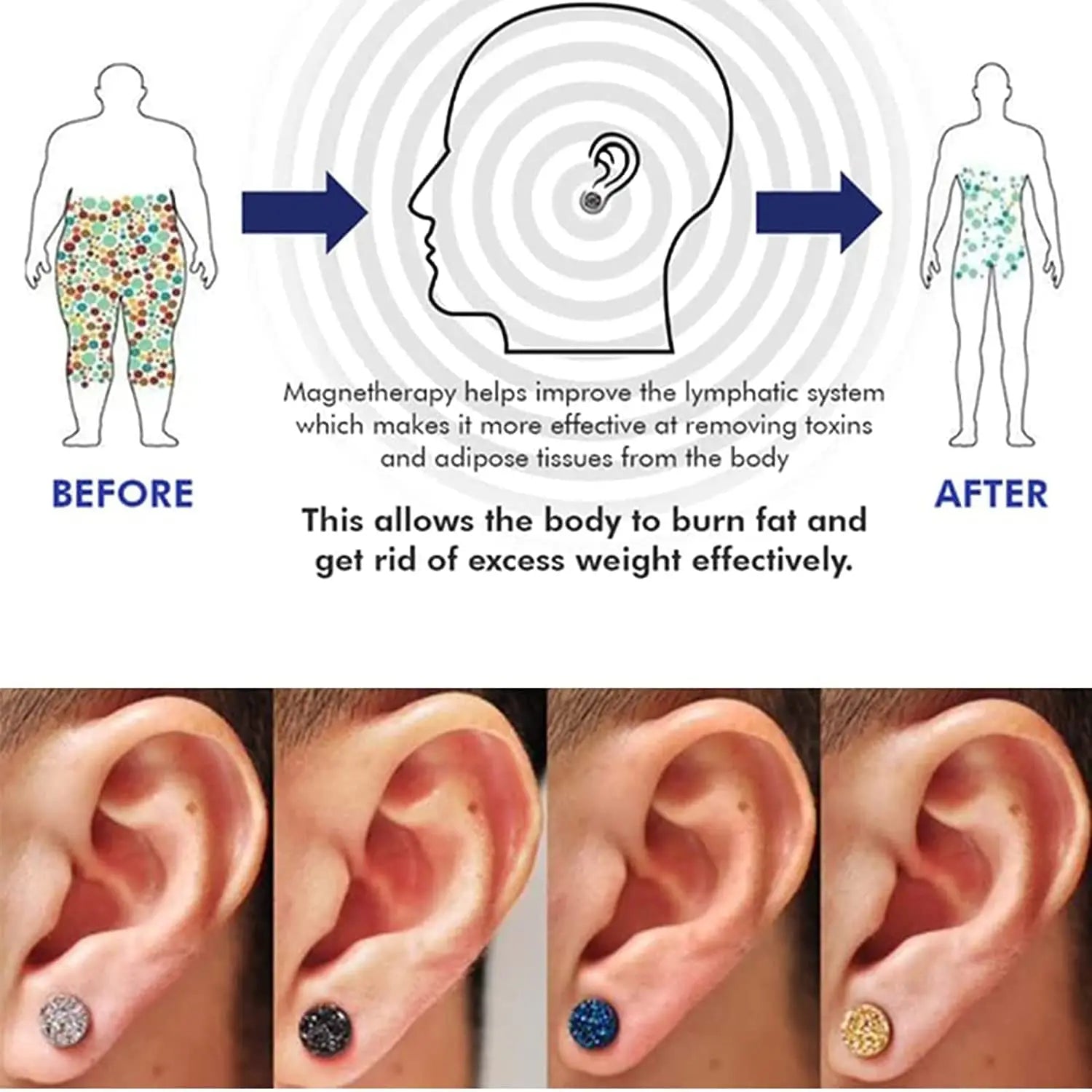 Magnetology Lymphvity Germanium Earrings | Non Piercing Magnetic Acupressure Ear Studs