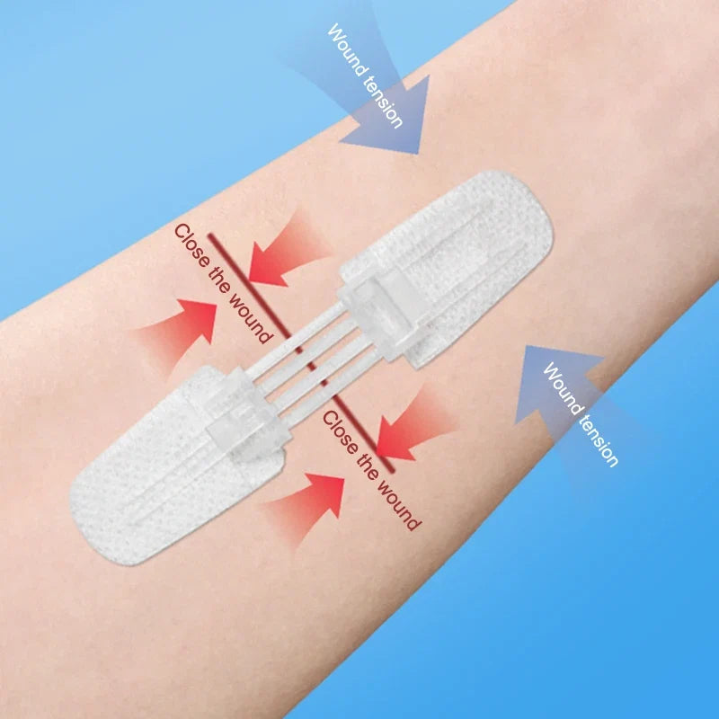 Zipper Bandage Wound Closure Patch | Suture-Free First Aid Dressing