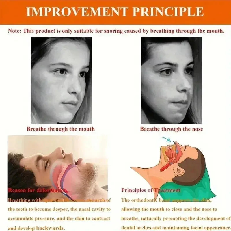 Anti-snoring Chin Strap | Open Mouth Corrector for Better Sleep