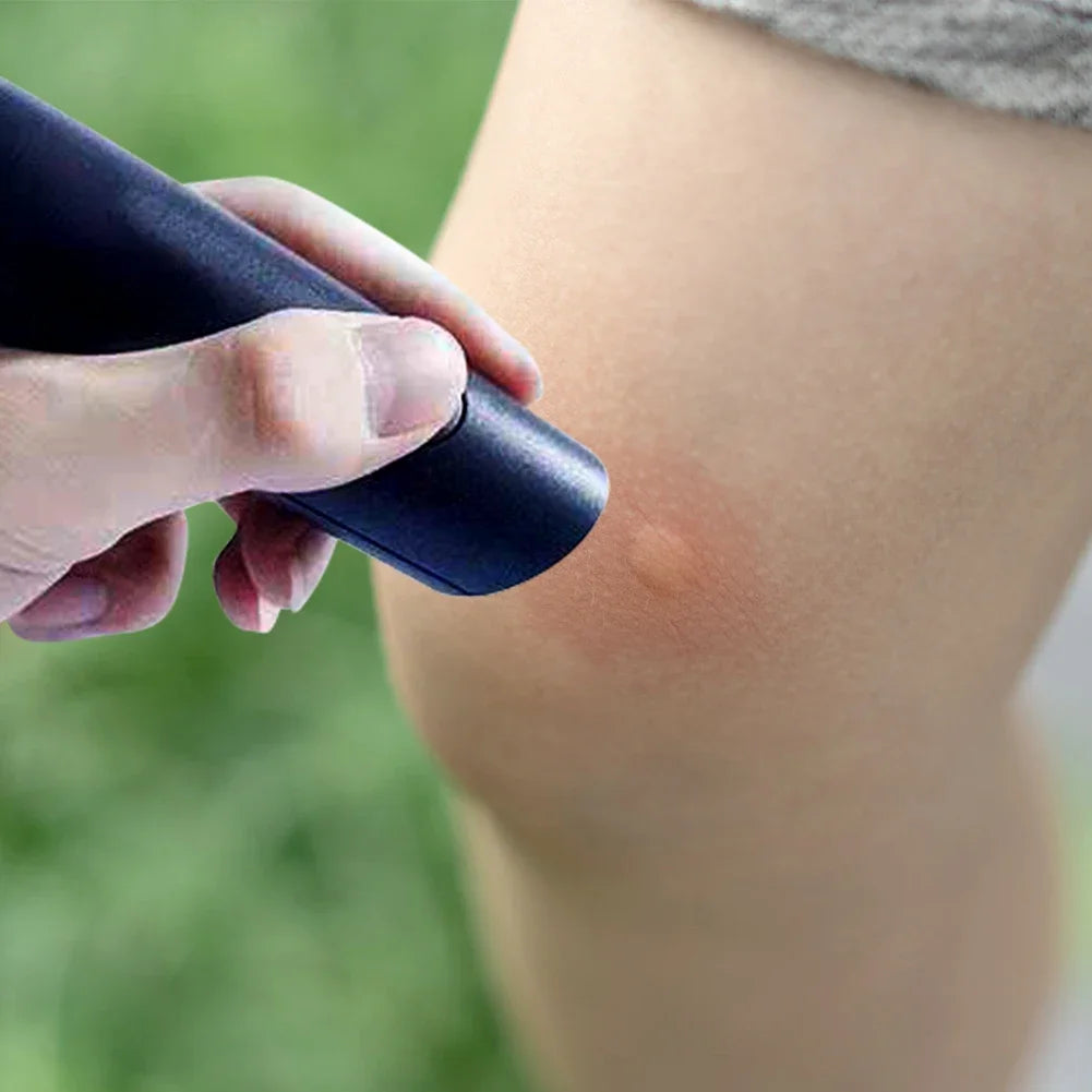 Electronic Insect Bite Relief Pen | Heat Pulse Itch Stopper