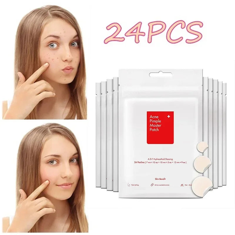 24 Pcs Hydrocolloid Acne Patches | Pimple Spot Treatment Stickers for Face