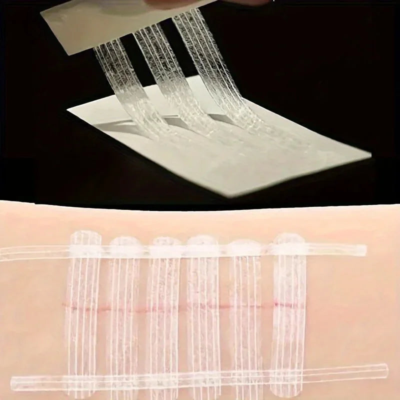 5 Strips Wound Skin Closure Strips | Medical Suture Free Surgical Tape