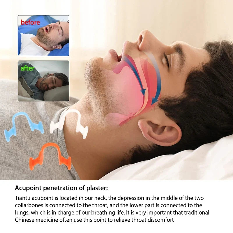 Nasal Dilator for Snoring | Stop Snoring Aid for Better Sleep