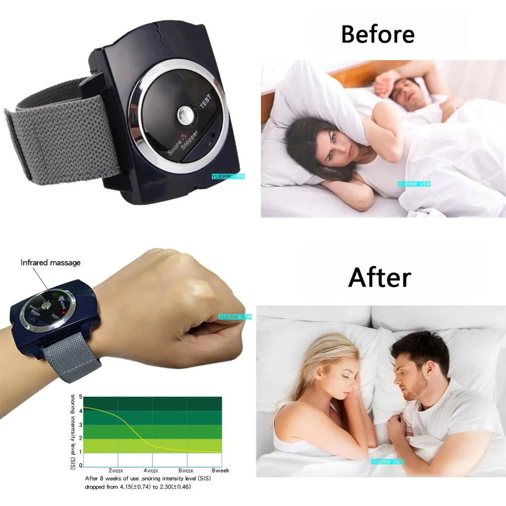 Anti Snore Wristband | Smart Sleep Aid with Biosensor