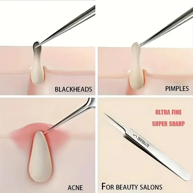 1/3pcs Extra Fine No. 5 Cellular Acne Blackhead Tweezers | Facial Beauty Tool for Skin Care