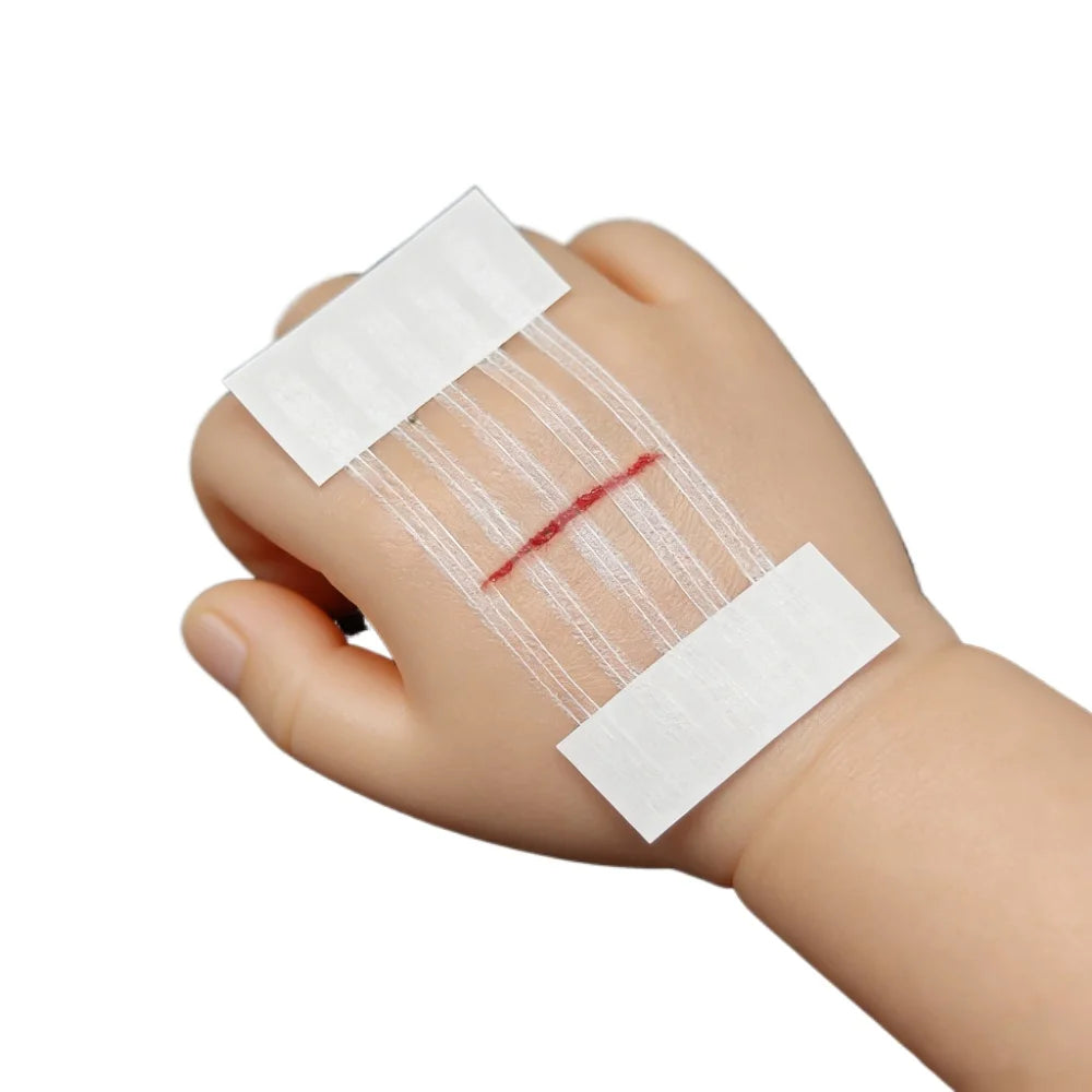 5 Strips Wound Skin Closure Strips | Medical Suture Free Surgical Tape