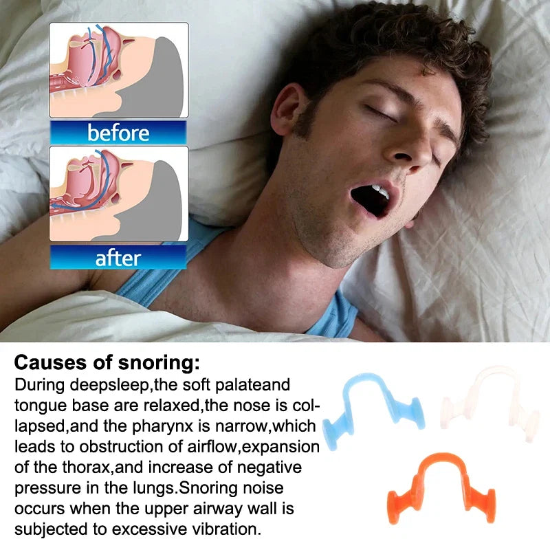 Nasal Dilator for Snoring | Stop Snoring Aid for Better Sleep