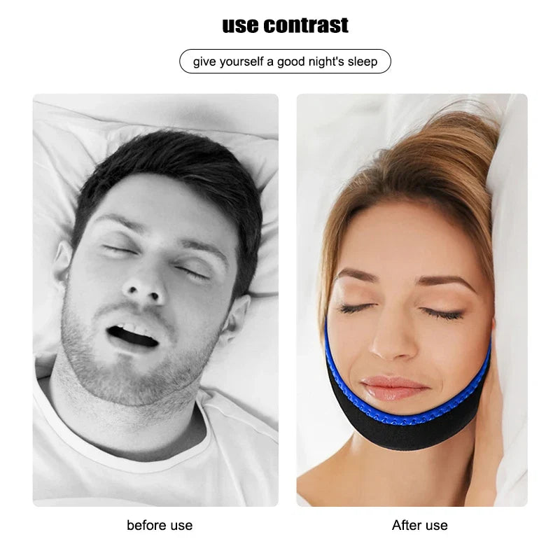 Breathable Anti Snore Chin Strap | Nylon Elastic Mouth Breathing Band for Better Sleep