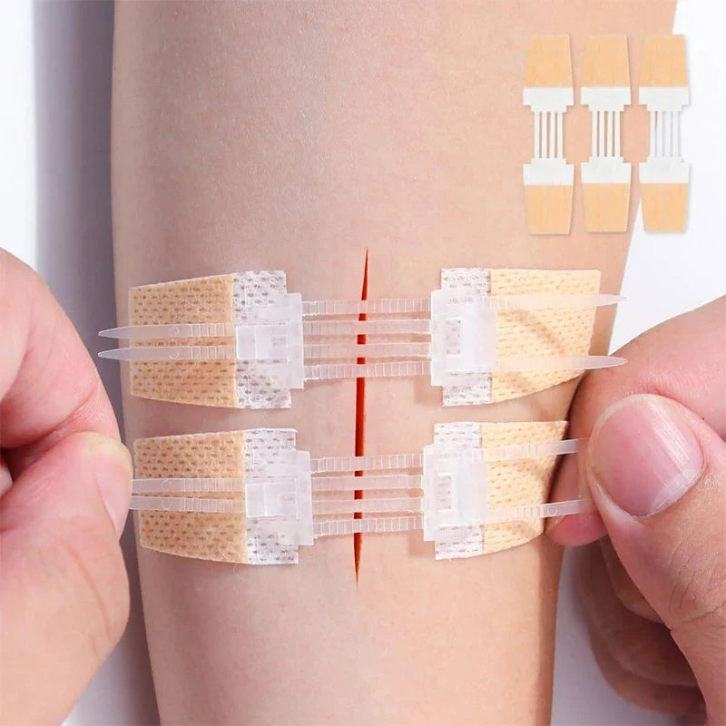 Zipper Bandage Wound Closure Patch | Suture-Free First Aid Dressing